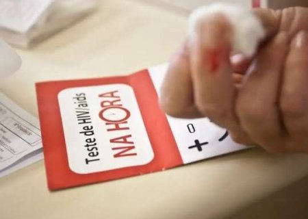 MS registrou 628 novos casos de HIV no ano passado